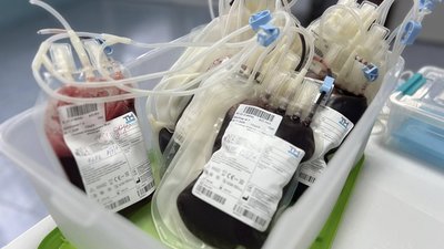 У Тернополі потрібні донори з негативним резус-фактором