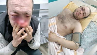 "Це було жахіття, він був весь в крові": у Тернополі чоловік у військовій формі побив інваліда. ФОТО