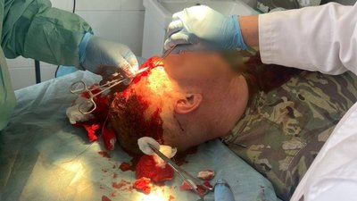 Жбурляли каміння і цеглу: роми вчинили криваву розправу над прикордонниками. ФОТО 18+
